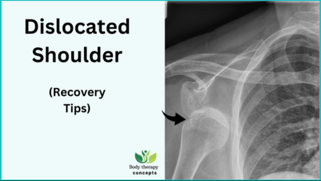 Shoulder dislocation :What you need to know?