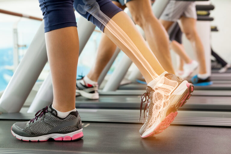 Digital,Composite,Of,Highlighted,Ankle,Of,Woman,On,Treadmill